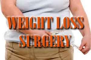 Unique weight loss surgery performed on Bangladeshi woman