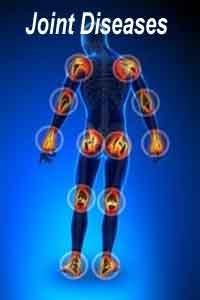 Bone marrow lesions can help predict rapidly progressing joint disease