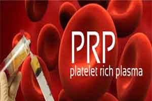 PRP injections: New alternative to knee surgery