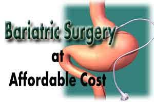 Lucknow: KGMU to offer Bariatric surgery at very affordable costs