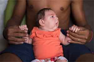 Brazil confirms 508 cases of microcephaly
