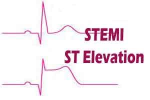 STEMI Care In India and the Real World: Challenges Ahead