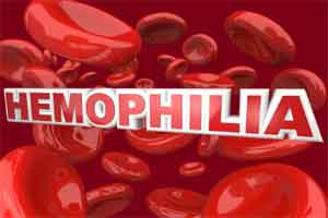 Only 15 percent of haemophilia patients diagnosed in India