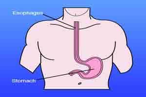 US doctors report first esophagus regrowth case