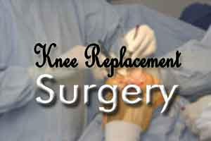 Knee surgery outcomes linked with education level