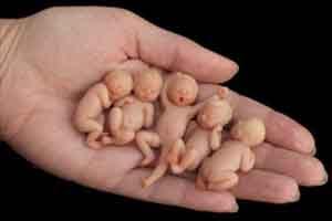 Chattissgarh: Quintuplets birth to go in Limca Book of Records