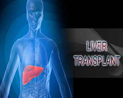 Yashoda Hospitals, Bansal Hospital ink pact for liver transplantation