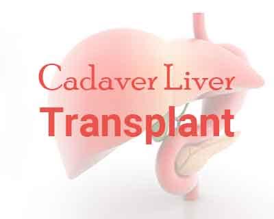 West Bengal: First cadaver liver transplant in Kolkata performed