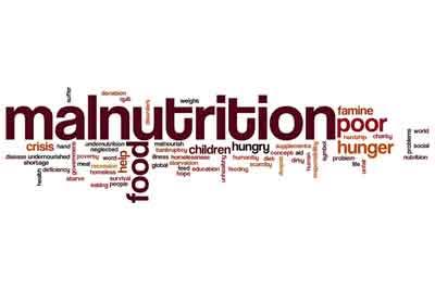 MP govt to issue white paper on malnutrition soon