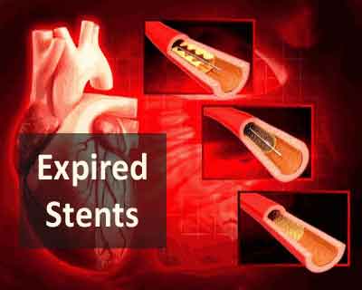 Tamil Nadu: Doctors to face action for using expired stents