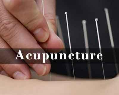 Puducherry: Govt may introduce Acupuncture in government hospitals