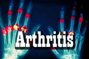 Arthritis Linked to Pollution in an AIIMS Study