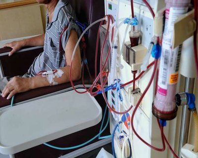 WB: Dialysis patients infected with HIV, Hepatitis in hospital