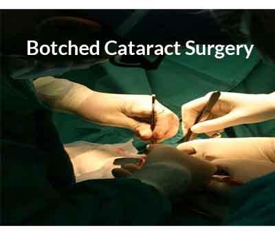 MP botched up cataract surgeries: Affected eyes of 2 patients removed