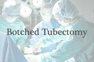 Woman dies due to botched tubectomy at public health centre