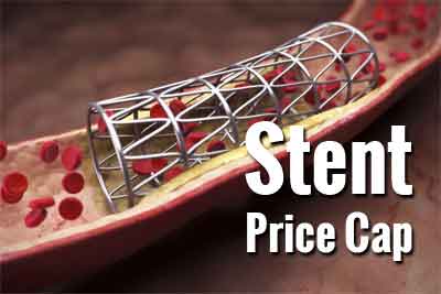 Stents pricing: Govt asks hospitals to make prompt refunds