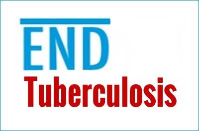 Get Rs 250 for notifying New TB case: Health Ministrys new scheme