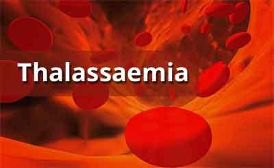 Govt, Coal India to help in treatment of kids suffering from thalassaemia
