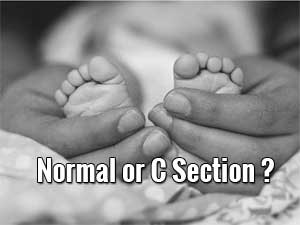 Doctor to lose license if C-Section rate exceeds 25 percent: MP State Woman Commission