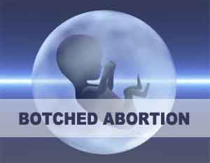 Botched Abortion: Self Proclaimed Ayurveda practitioner arrested after patients death