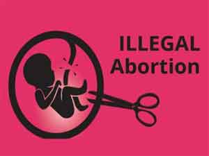 Cancel license of doctors involved in Illegal Abortions: Authorities write to Medical Council of India