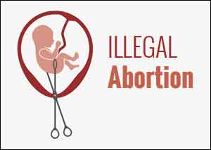 Doctor in custody for performing illegal abortions