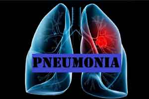 Pneumonia cases rise to 44, China to identify cause of outbreak