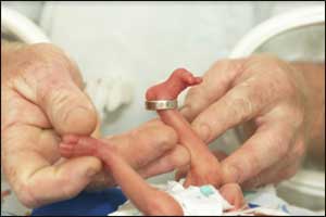 Medical experts lay down policy for foetal viability