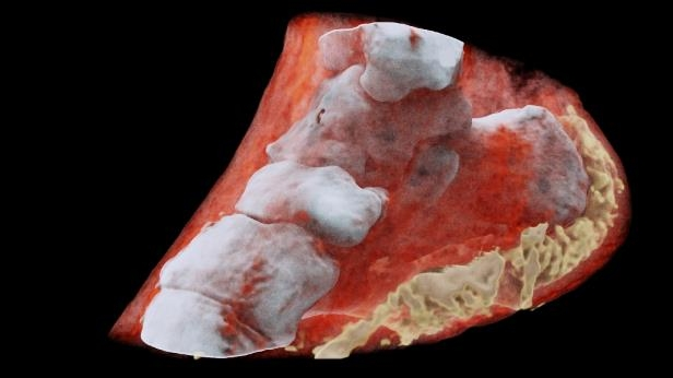 Medical Breakthrough: First-ever 3-D Colour  X-ray performed on a human
