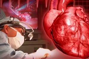 Apollo Chennai completes 50,000-plus heart surgeries