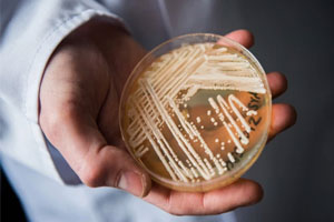 No clinical evidence of new deadly fungus Candida auris in India yet