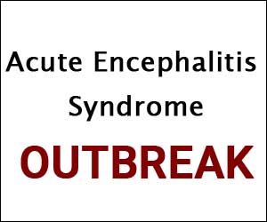 Acute Encephalitis Syndrome Outbreak claims lives of 150 children: SC directs Centre, Bihar to respond